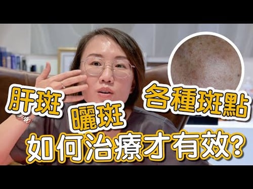 肝斑、色素不均是如何造成?來看看莊盈彥醫師治療肝斑的方式有哪些!