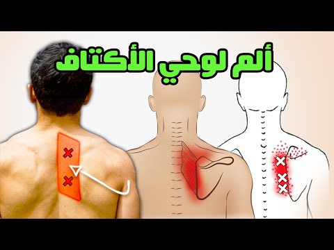 Sharp Back Pain Between Shoulders? 5 Exercises for quick Rhomboid Relief #ShoulderBladeRelief