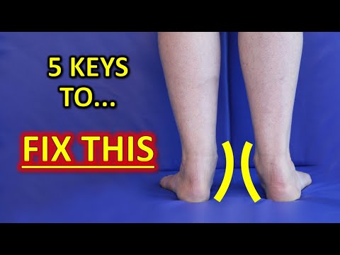 The 5 KEYS To Improve Flat Feet (Fallen Arches) & Foot Overpronation