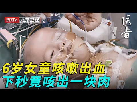 6岁女童咳嗽出血,下秒竟咳出一块肉,医生一看是肿瘤紧急手术保命【医者】