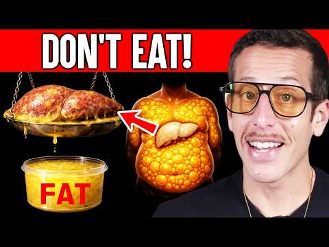 Strictly Avoid These 5 Foods If You Have A Fatty Liver! | Ben Azadi