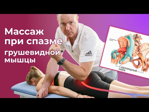 Piriformis Syndrome. Sciatic Nerve Massage