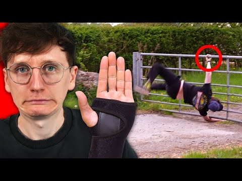 Revealing What Happened To My Arm..