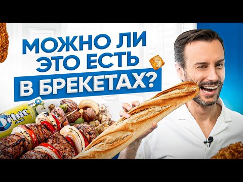 Мифы о продуктах, которые нельзя есть с брекетами