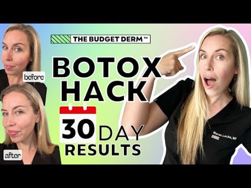 30-Day Botox Hack Results! | $20 Anti-aging Hack | The Budget Dermatologist