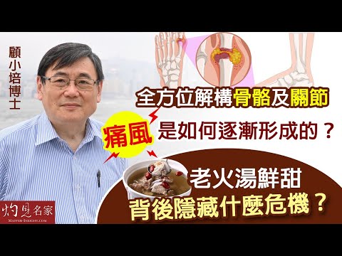 【字幕】顧小培博士:全方位解構骨骼及關節 痛風是如何逐漸形成的?老火湯鮮甜背後隱藏什麼危機?| 骨骼健康上集 《預防勝於治療》(2022-06-26)