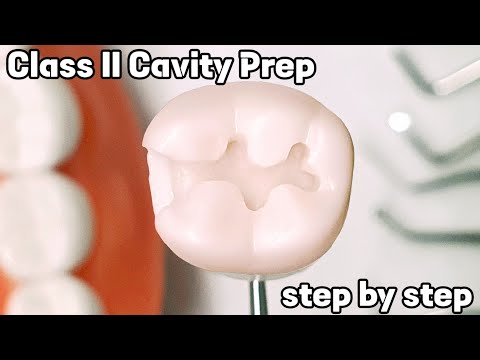 Class II Amalgam Preparation_Step by Step