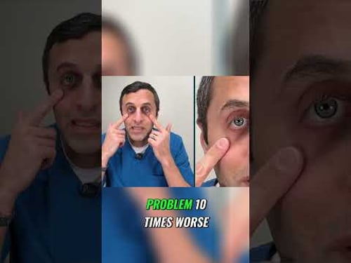 Lower Eyelid Retraction: The Hidden Risk of Eye Procedures #shorts