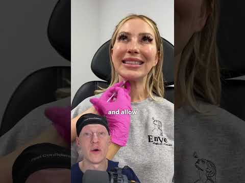Is Botox Into Neck Platysmal Bands A GAMECHANGER?