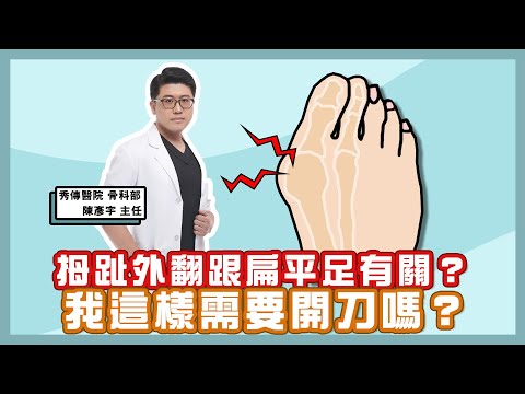 #拇趾外翻 跟扁平足有關?我這樣需要 #開刀 嗎?| 黃丹尼 ft. 秀傳紀念醫院 骨科部 陳彥宇主任 【543男方基地】