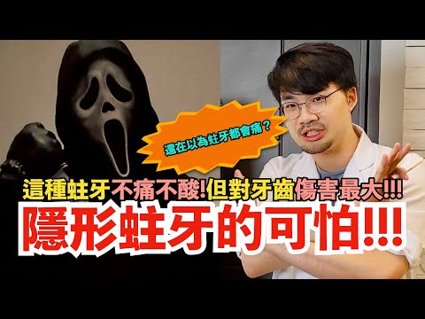 【沒感覺≠沒蛀牙】這種蛀牙不痛不酸,但對牙齒傷害最大!太重要了,分享給你朋友讓他知道無感蛀牙的危險