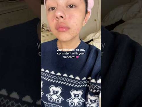 trust the process! it will all be so worth itπ€π»π₯Ή #skincare #skincaretips #skincareroutine