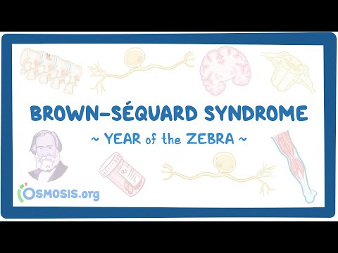 Brown-Séquard syndrome (Year of the Zebra)