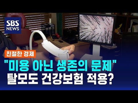 "미용 아닌 생존의 문제"…탈모도 건강보험 적용? / SBS / 친절한 경제