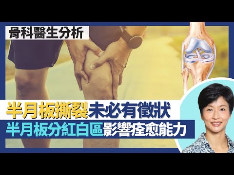 膝蓋半月板撕裂|退化性撕裂未必有徵狀 急性勞損性撕裂可致鎖膝!半月板分紅白區 紅區可修復 白區痊愈能力低或要切除!死亡三角:十字韌帶、副韌帶、半月板?|王建芳醫生 骨科醫生張文康醫生|人類健康研究所