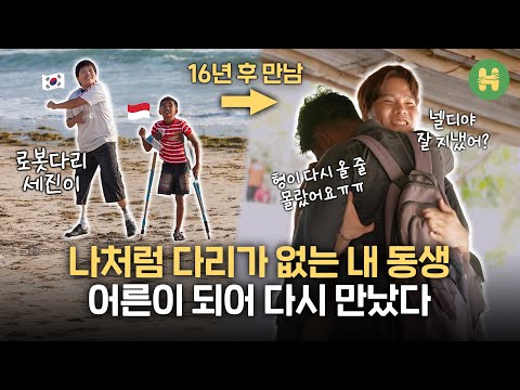 My Indonesian Little Brother Received My ‘Robot Leg’ 16 Years Ago — Now I’m Attending His Graduation