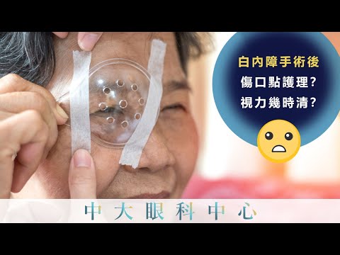 中大眼科 x 港台:做完白內障手術,傷口點護理?視力幾時清?