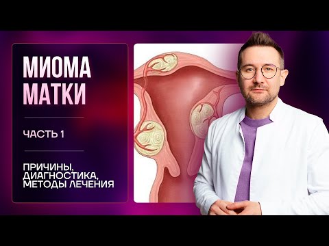 МИОМА МАТКИ. Причины. Диагностика. Методы лечения миомы матки | Гинеколог Дмитрий Лубнин