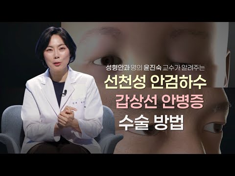 성형안과 윤진숙 교수가 알려주는 선천성 안검하수, 갑상선 안병증 수술방법 | #EBS건강