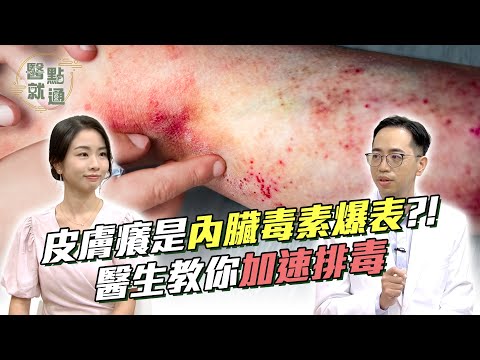 皮膚癢是內臟毒素爆表?醫生教你快速排毒止癢 Itchy Skin? Fast Detox Tips!|【#醫點就通】EP12|#緯來育樂台|#海芬 ft.#陳敬智 #張語希|2024.12.11