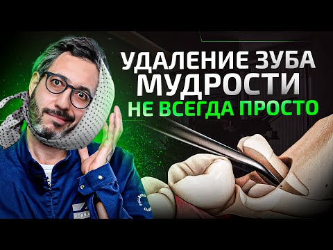 Почему у кого-то легко, а у кого-то тяжело проходит удаление зубов и реабилитация?
