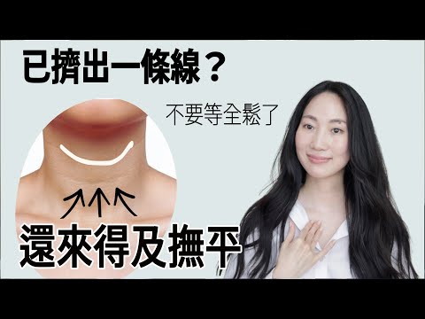 脖子最洩漏年齡!脖紋消失最快的方法@DrGrace
