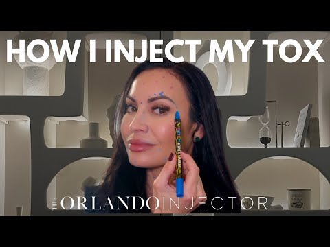 MY FULL FACE BOTOX MAPPING