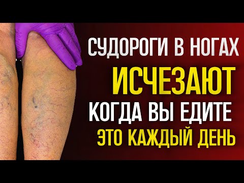 ТОП-3 продукта против СУДОРОГ в ногах у пожилых - даже НОЧЬЮ