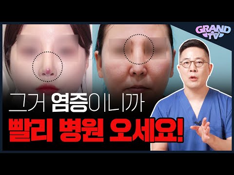 ์ฝ์ฑํ ์ผ์ฆ ์๊ฐ์ง๋จ, ์ด๋ด ๋ ๋ฌด์กฐ๊ฑด ๋ณ์ ๊ฐ์ธ์!!