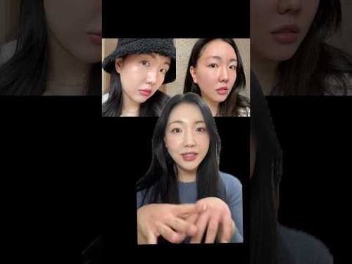 Part 2: how I treated my smile lines and jowls in Korea