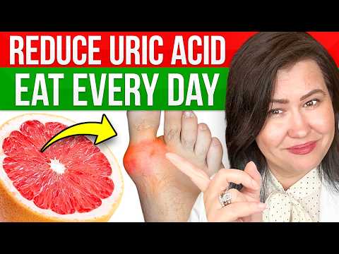 15 SUPER Foods To Reduce URIC ACID (Gout): Rheumatologist Explains