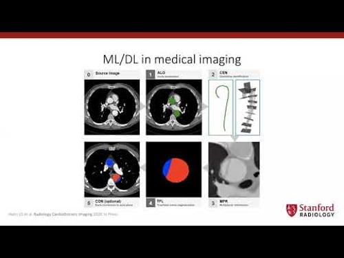 Webinar 31 Preparing medical imaging data for machine learning by Martin Willemink