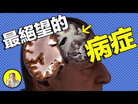 無解病症,散戶勘破驚天騙局。老年癡呆竟然也會傳染?阿爾茲海默真的無法治癒嗎......|總裁聊聊