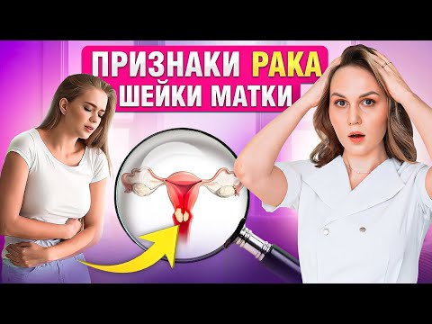 Неочевидные признаки РАКА шейки матки. Как не упустить!