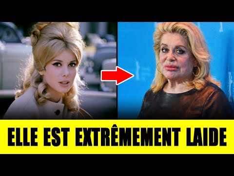 11 stars féminines françaises dont le visage s'est détérioré après la chirurgie esthétique