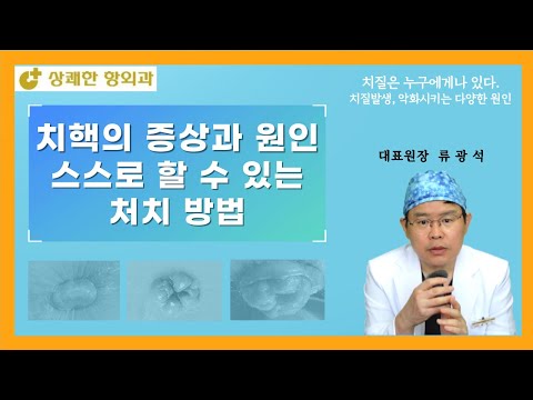 치핵의 증상과 원인, 스스로 할 수 있는 처치법