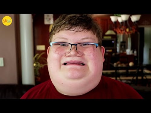 An Autistic Teen with Uncontrollable Rage (He Wishes He Could Stop)