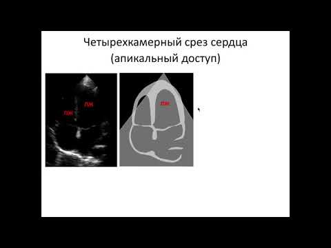 Ультразвуковая анатомия сердца