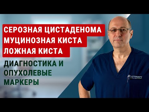 Ложная киста, серозная цистаденома, муцинозная киста: диагностика, опухолевые маркеры | Юрий Гольдес