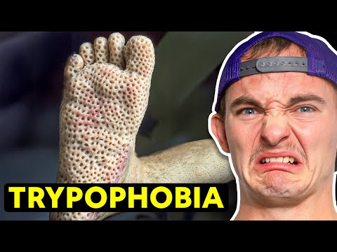 World's Weirdest Fears Exposed