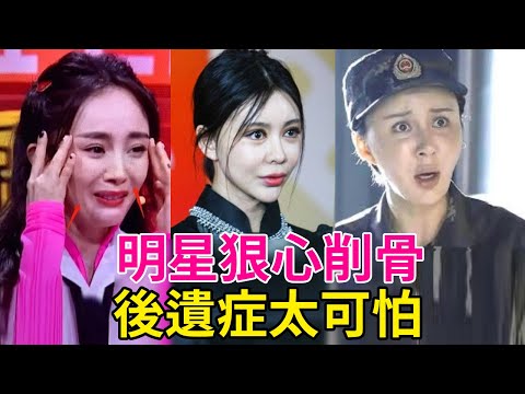 明星狠心削骨後遺症太可怕! 臉崩、醜到不敢照鏡子,花百萬都不能修復 #扒爪娛#陳小紜#鞠婧禕#楊冪#秦嵐#聶遠#王鷗#尚雯婕#張歆藝#劉孜#孫菲菲