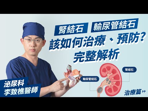 【泌尿科李致樵醫師】尿路結石治療篇(腎結石、輸尿管結石)|泌尿科診療室