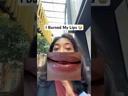 I FORGOT TO BRING LIP BALM SPF TO MY HONEYMOON IN NEW ZEALAND đ