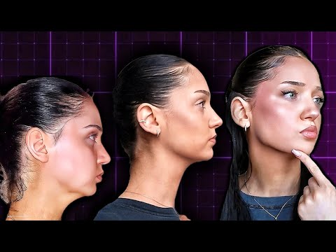 My Full Mewing & Thumbpulling Routine