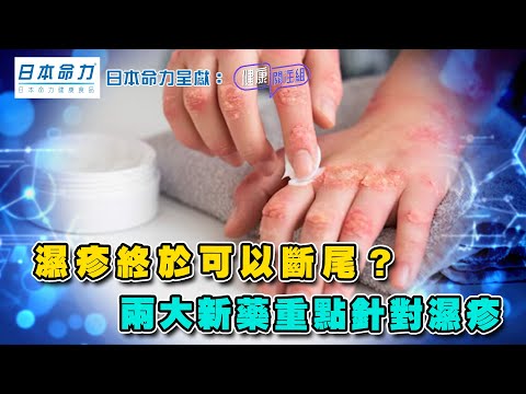 濕疹終於可以斷尾?兩大新藥重點針對濕疹 | 日本命力呈獻: 健康關注組 | EP372 | 濕疹 | JAK抑制劑 | 生物製劑 | 黃芳雯 | 麥詩敏 | HOY TV 77台