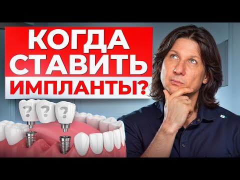 Почему зубы начинают ВЫПАДАТЬ? / 5 признаков, что вам срочно нужен имплант!