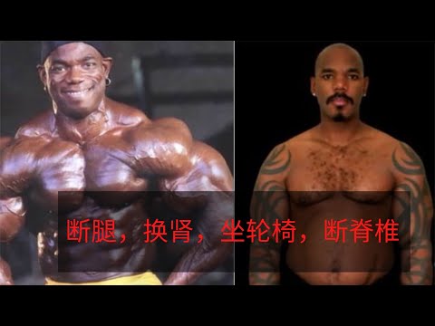 健美史上7位王者退役後的前後對比!有的断腿,换肾,坐轮椅,断脊椎