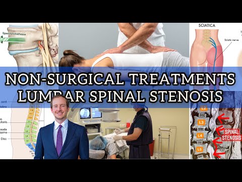 Non-Surgical Treatment For Lumbar Spinal Stenosis (Part 1)