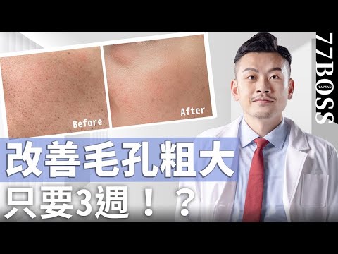毛孔粗大、黑頭一堆?超有效必買保養品清單,21天效果好到哭!【77老大】