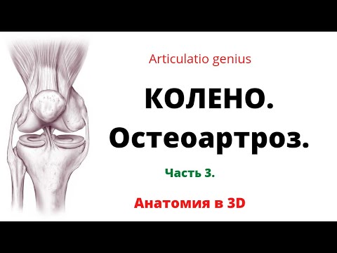 Коленный сустав. Часть 3. Остеоартроз коленного сустава. Краткая патоанатомия в 3D